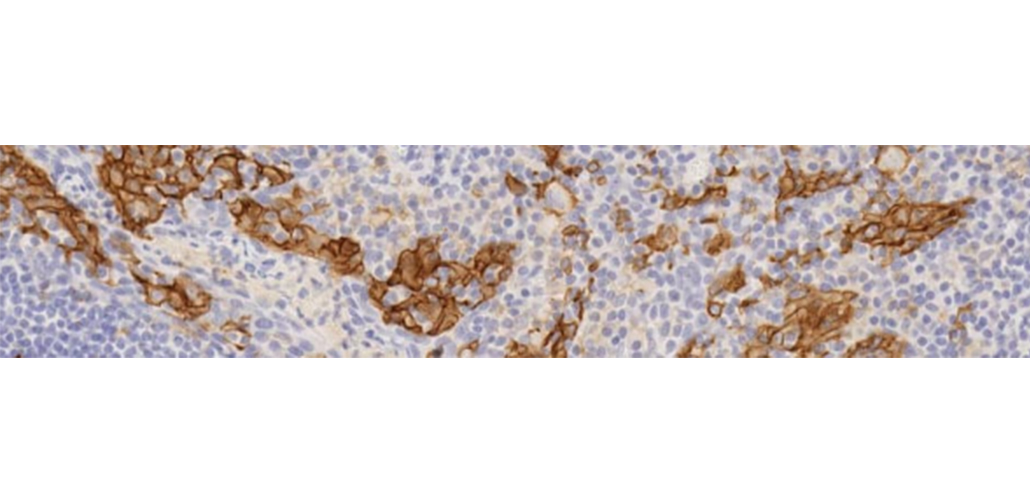 Immunohistochemistry trial panels for Immuno-oncology from Abcam!